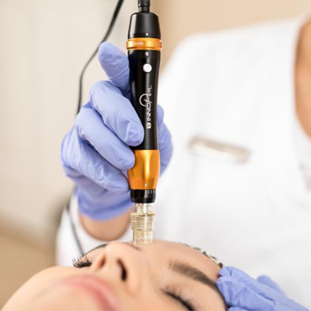 microneedling closeup