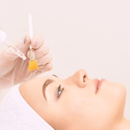Chemical peel application being applied